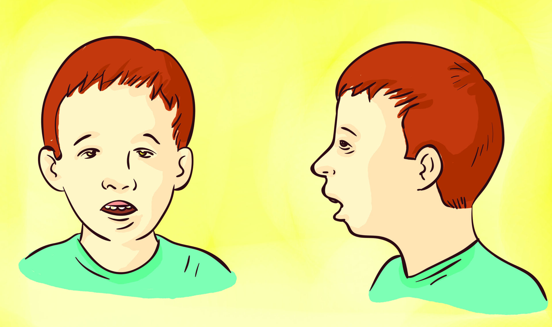 Front and side view of red-haired boy