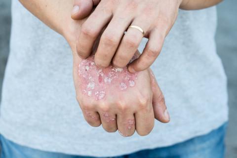 skin problems and breathing